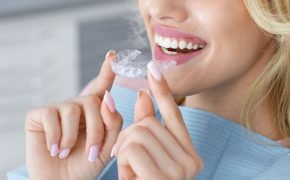 Seguro dental completo: 4 Coberturas indispensables